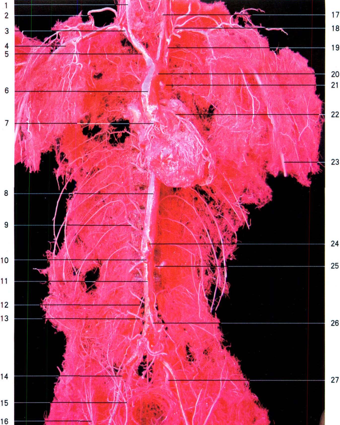 axillary artery图片